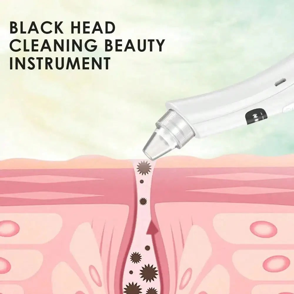 Blackhead Remover