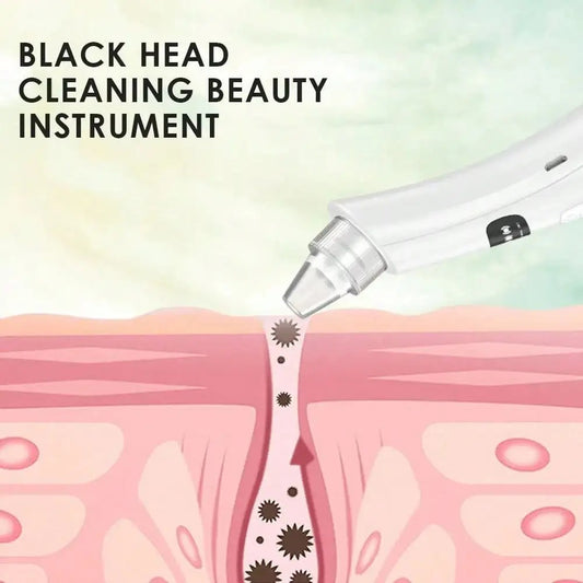 Blackhead Remover